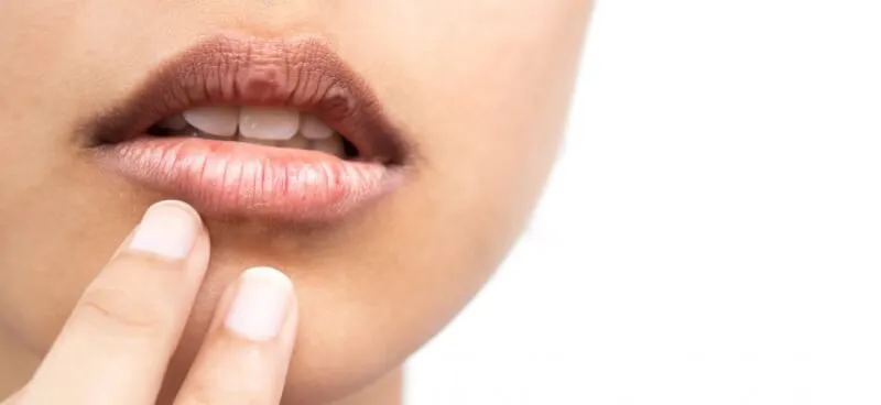 Soothing Strategies for Relieving Dry Mouth Symptoms at Night
